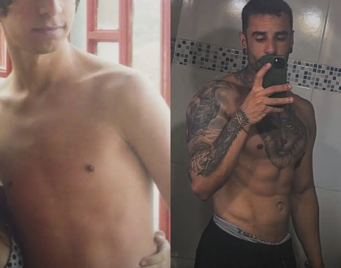 Douglas Campos, antes e depois